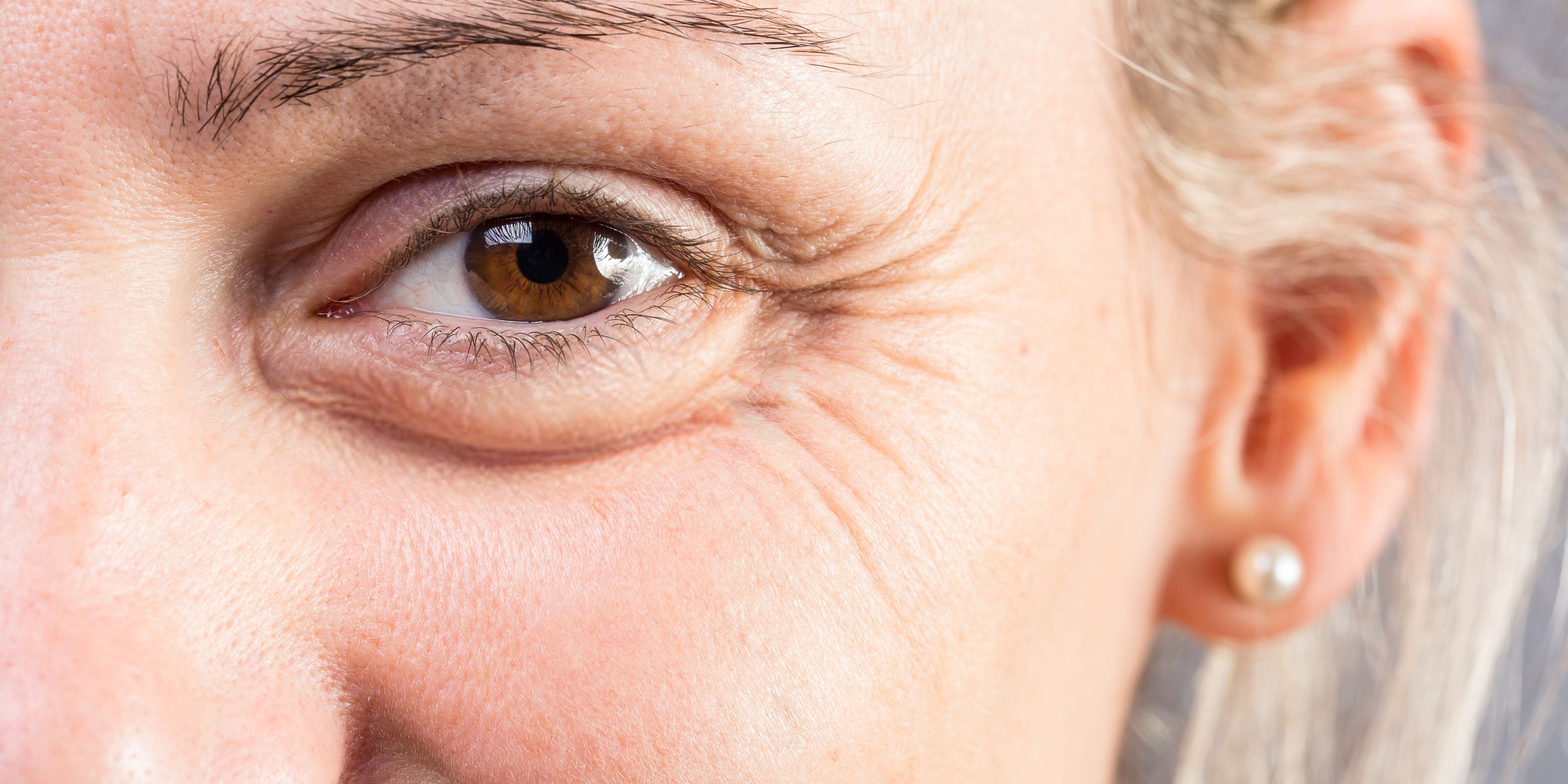 Arrugas y líneas finas