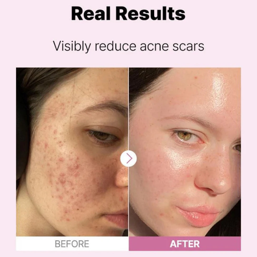 COSRX The Niacinamide 15 Serum 20ml 8